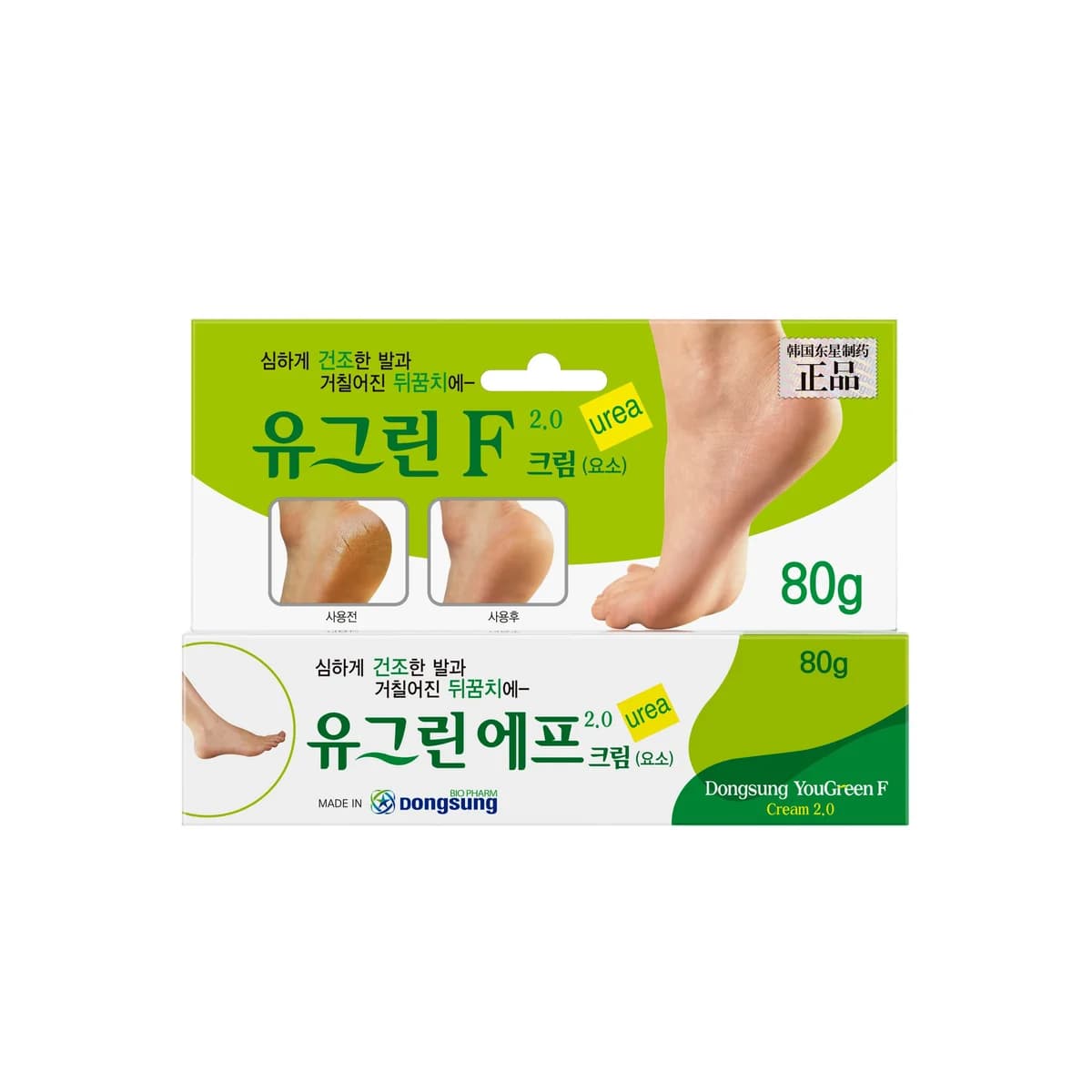 Dongsung YouGreen F Cream (Urea 25%) - 80g