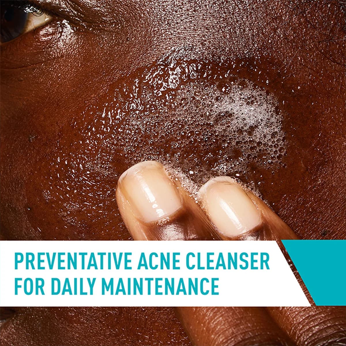 Cerave Acne Control Cleanser For Acne-Prone Skin thumbnail 4