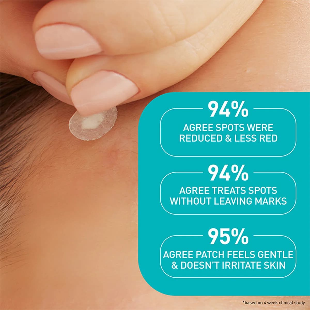 Cerave Blemish Barrier Patches Oily, Blemish-Prone, and Sensitive Skin thumbnail 6