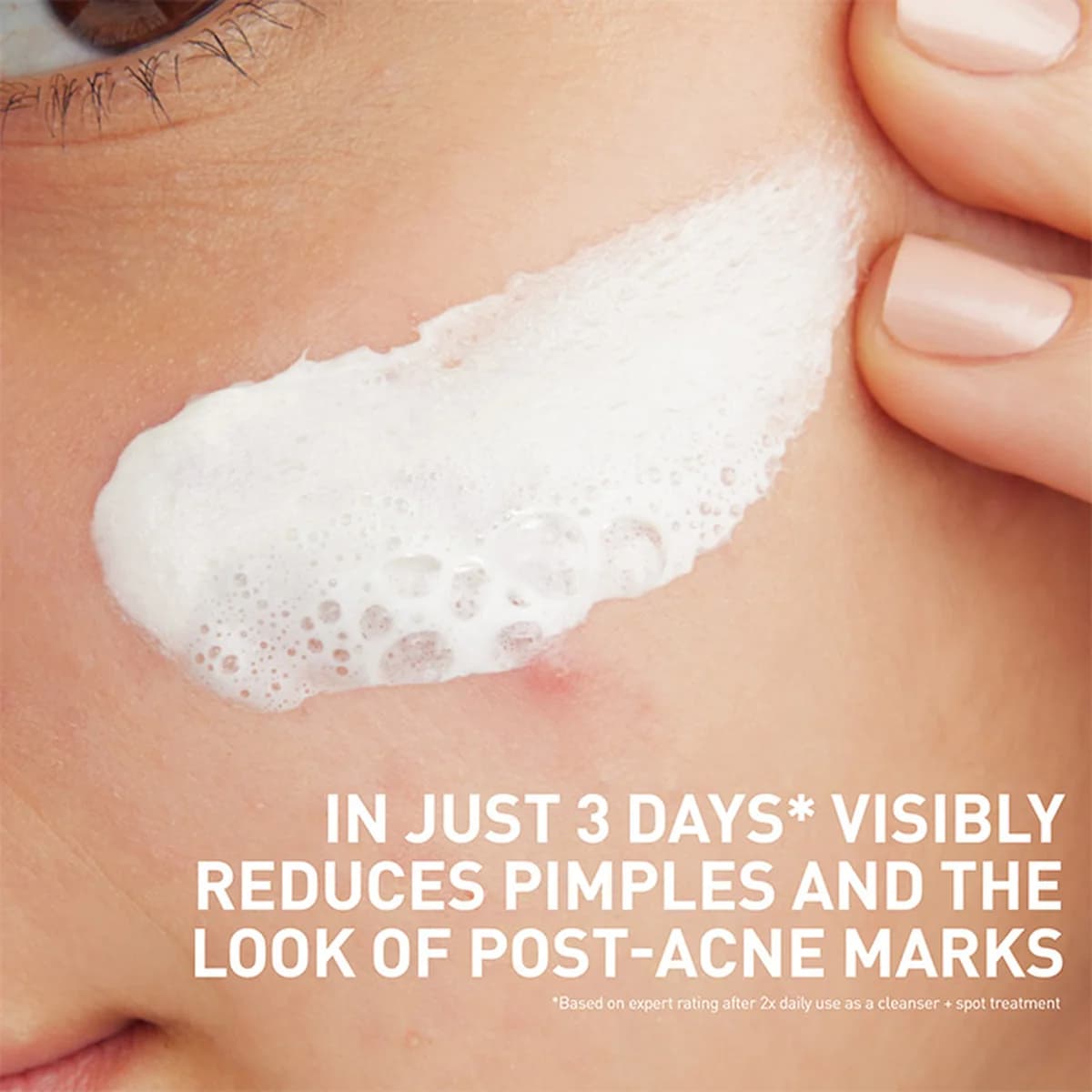 Cerave Acne Clay To Foam Cleanser For Acne-Prone Skin thumbnail 2