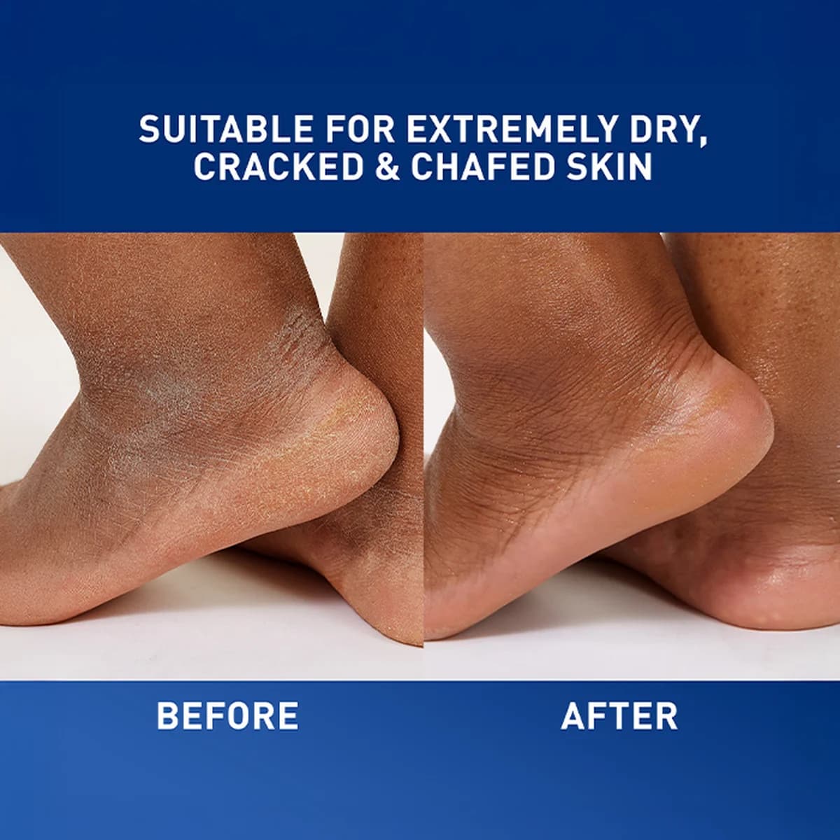 Cerave Healing Ointment For Dry to Very Dry Skin thumbnail 3