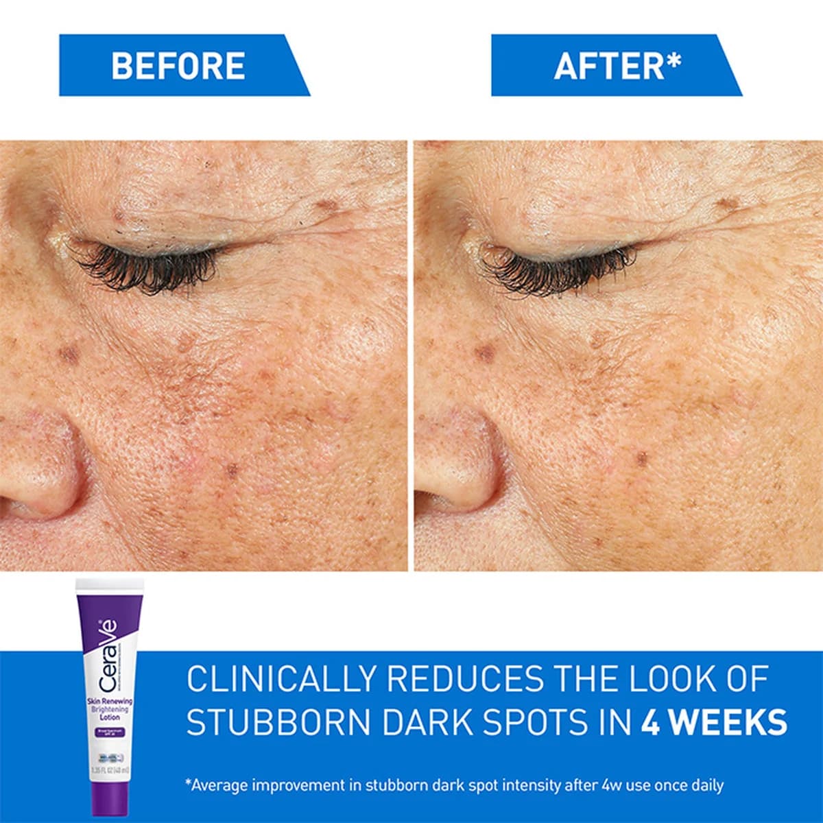 Cerave Skin Renewing Brightening Lotion with SPF 30 For Normal to Dry Skin thumbnail 5
